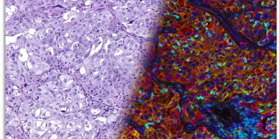 digital-pathology-ai-stained-tissue.jpg
